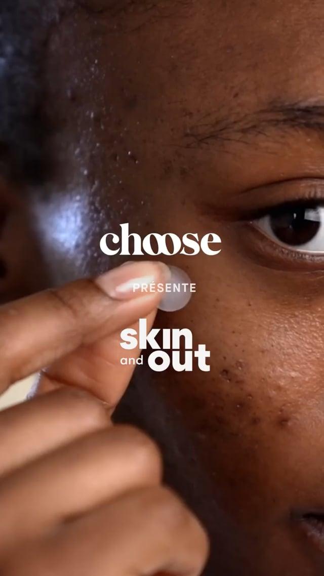 video Choose x Skin and out - Split screen